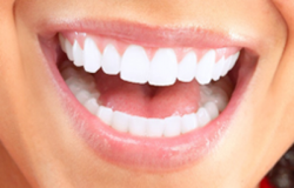 歯のセラミックの種類は何があるの？特徴を知って後悔しない選択を！サムネイル